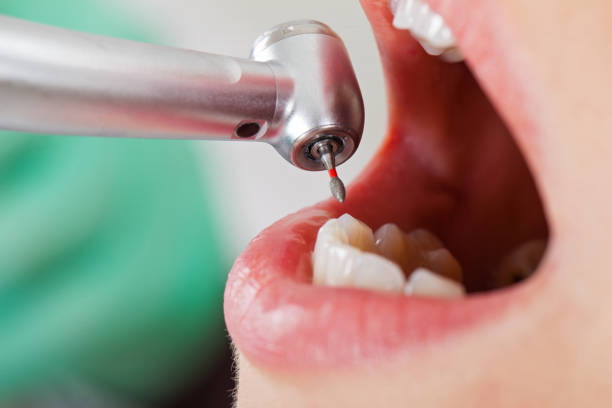 Emergency Dentist Open Today in TX